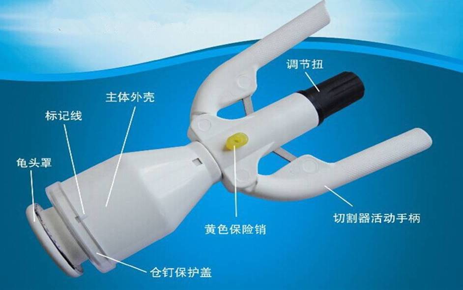 一次性吻合器割包手術(shù)視頻，了解過程與注意事項(xiàng)，一次性吻合器割包手術(shù)詳解及注意事項(xiàng)視頻指南